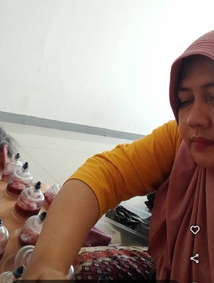 Terapi Bekam Yenining